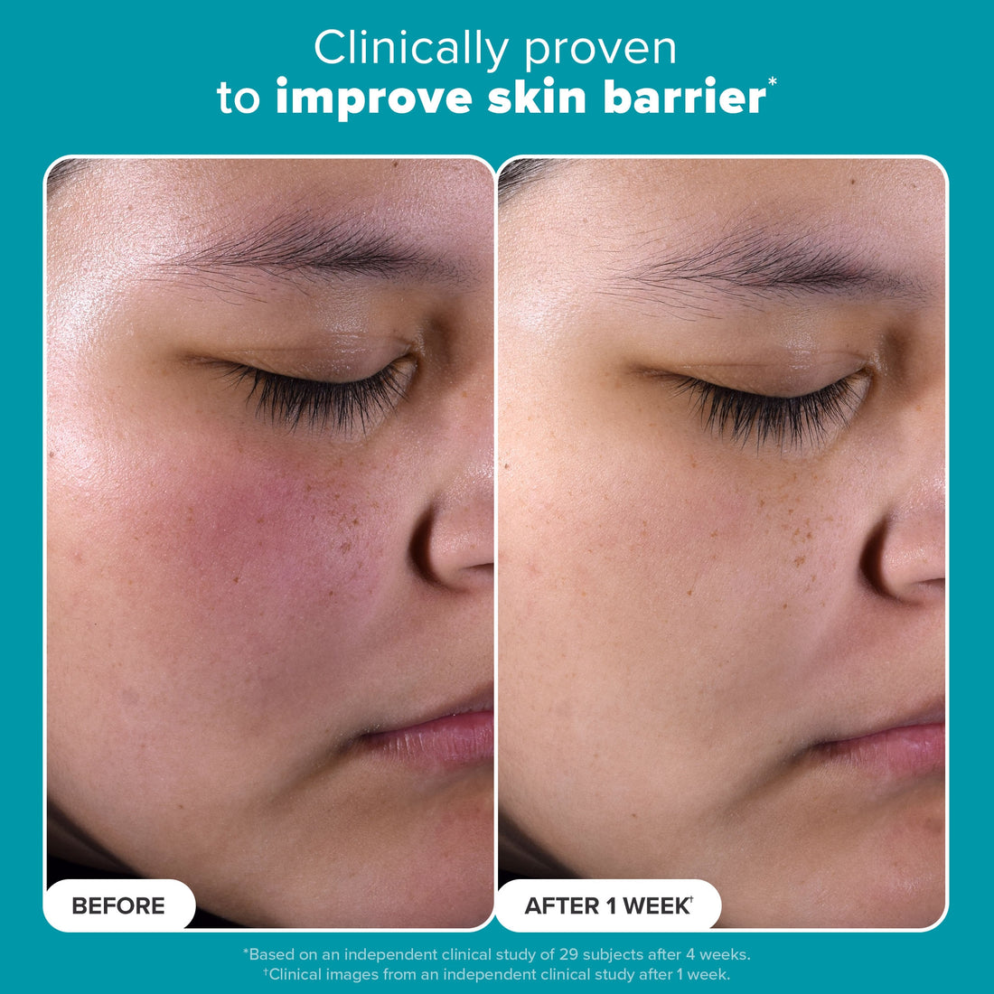 Paula's Choice Skin Perfecting 2% BHA Liquid Exfoliant - Trial Size (30ml)