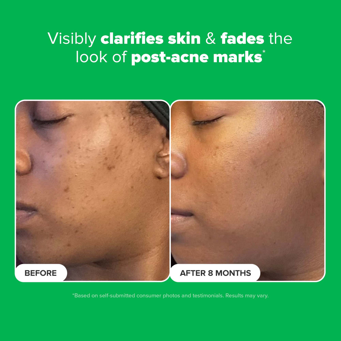 Paula's Choice 10 Azelaic Acid Booster (1 fl. oz.)