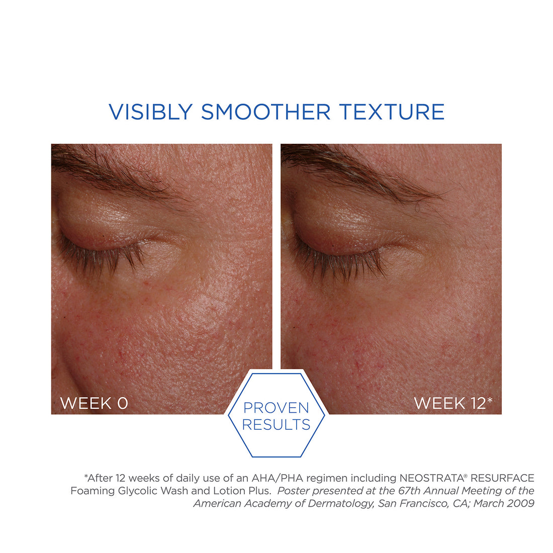 NEOSTRATA Resurface Foaming Glycolic Wash AHA 20 125ml