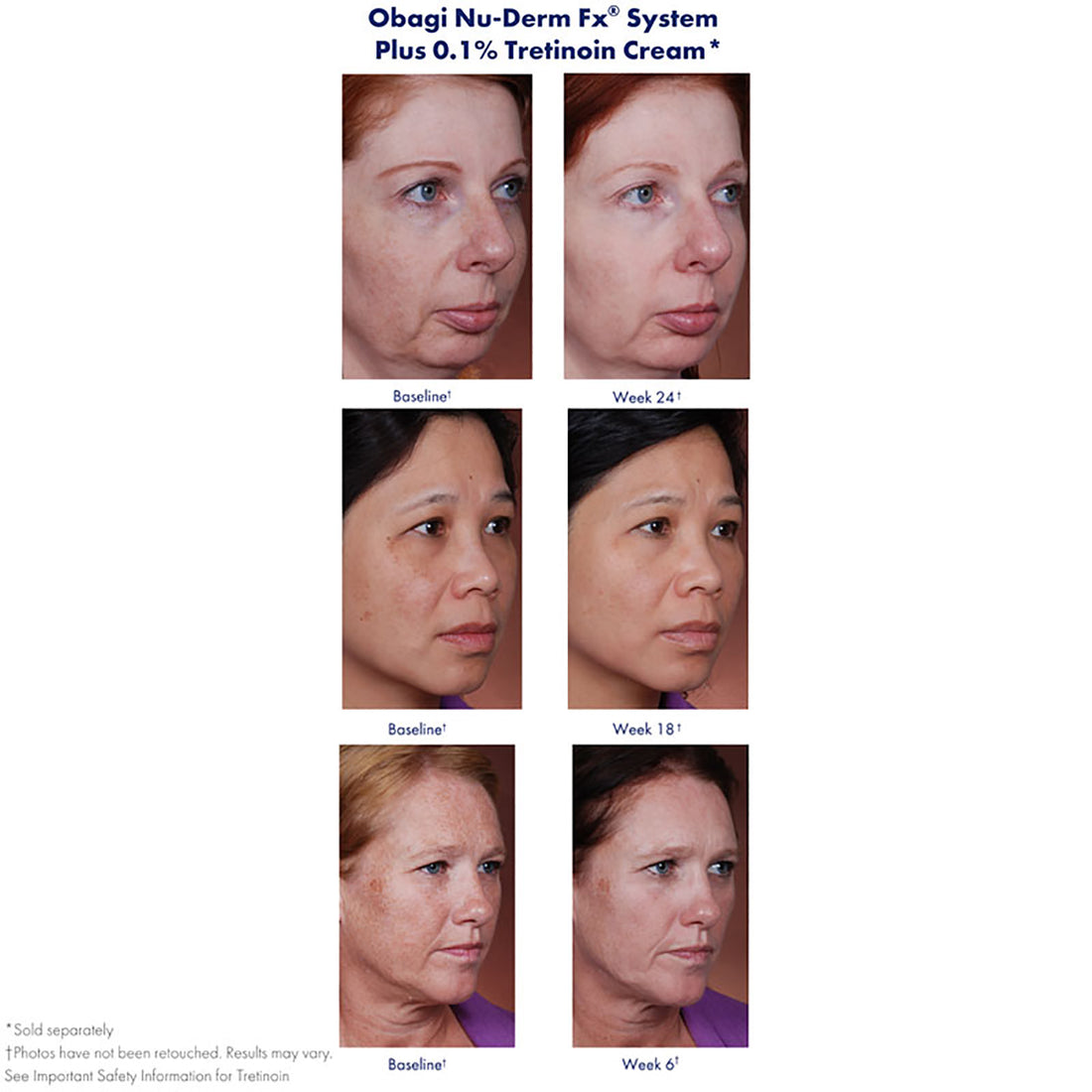 Obagi Medical Nu-Derm Toner (6.7 oz.)