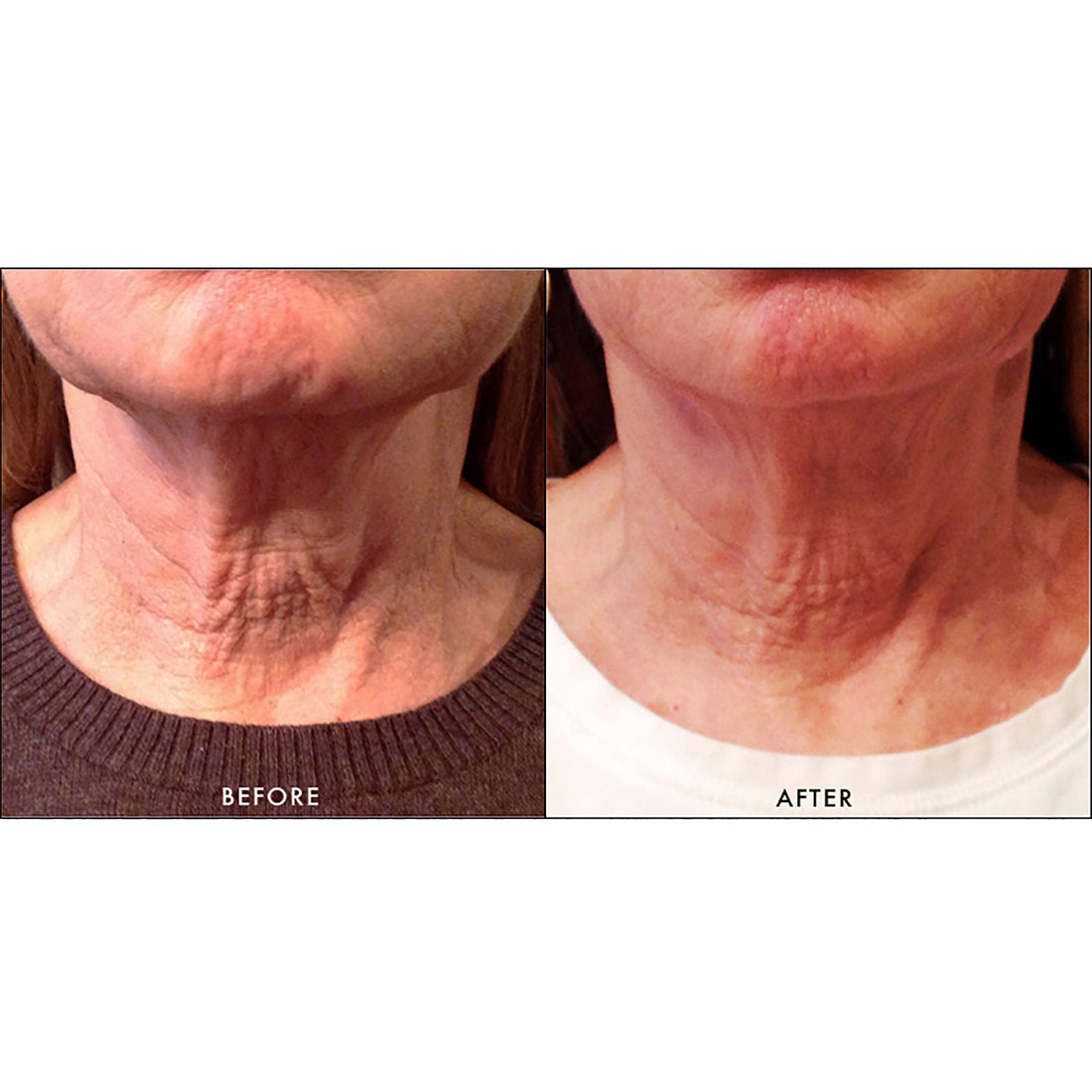 Replenix Lifting Firming Neck Cream (1.7 fl. oz.)