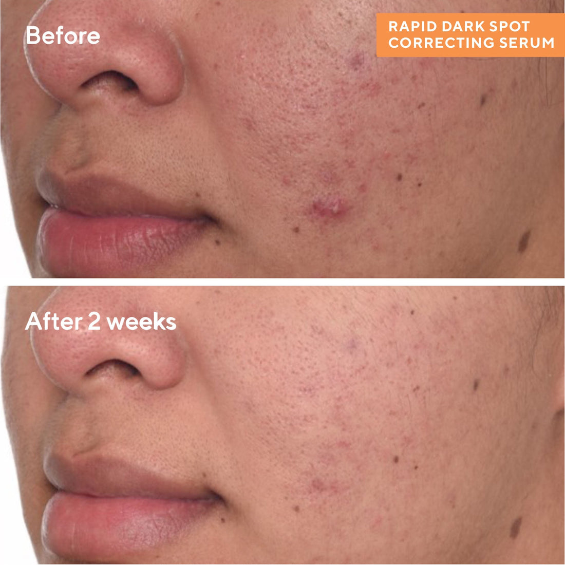 Murad Rapid Dark Spot Correcting Serum 1 oz