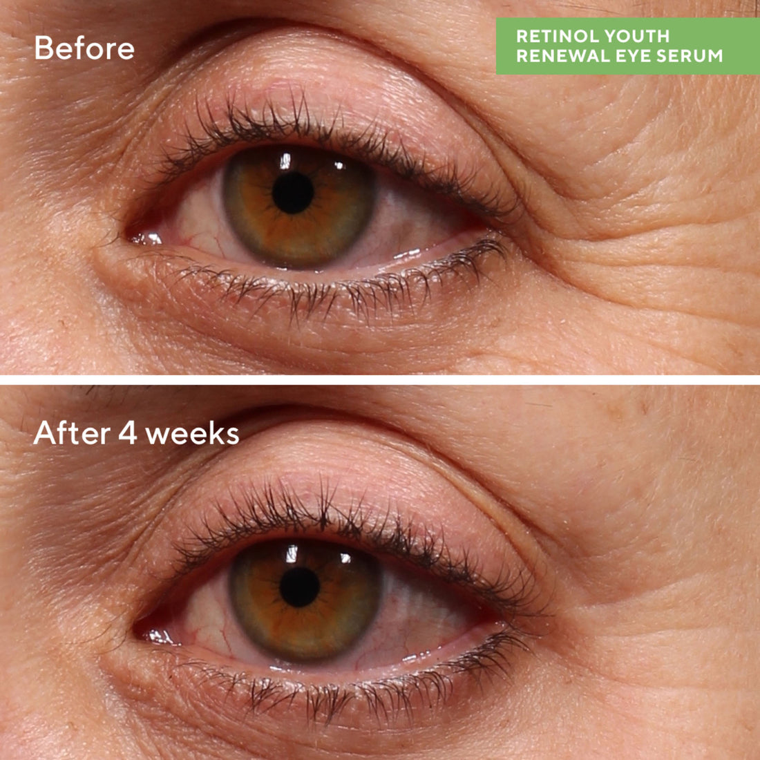 Murad Retinol Youth Renewal Eye Serum 0.5 oz