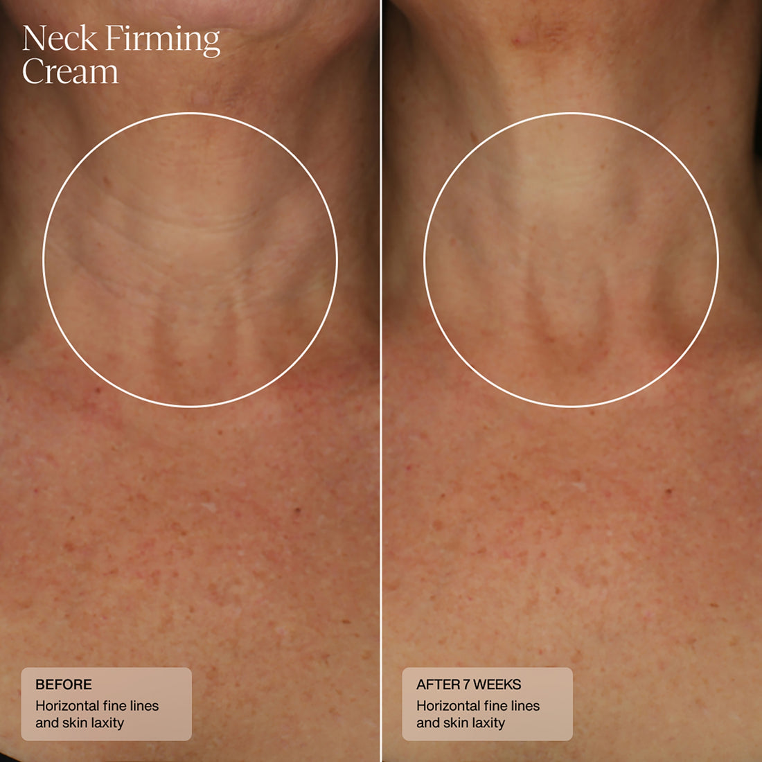 SENTÉ Neck Firming Cream 1.7 fl. oz