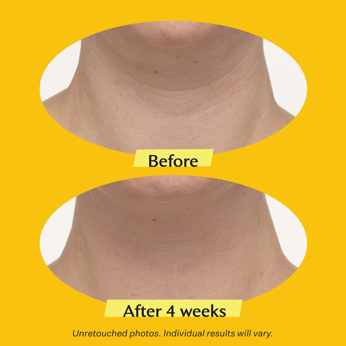 StriVectin TL Advanced Tightening Neck Cream PLUS 50ml