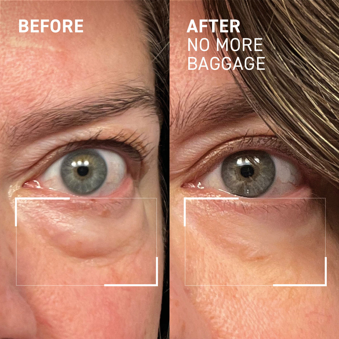 Dr. Brandt Needles No More No More Baggage Eye Gel 15g